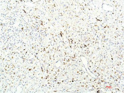 JAK1 Monoclonal Antibody