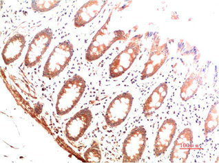 COL1A1 Monoclonal Antibody