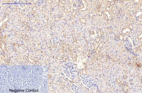 COL1A1 Monoclonal Antibody