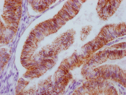 CLDN7 Monoclonal Antibody