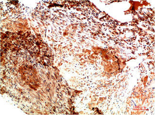 COL2A1 Monoclonal Antibody