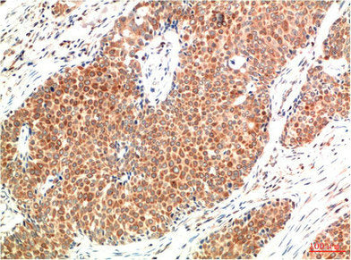 ATM Monoclonal Antibody