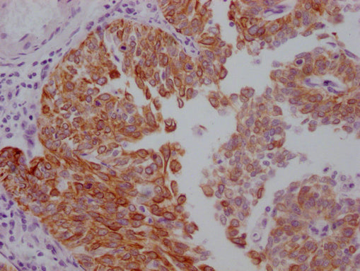 KRT17 Monoclonal Antibody
