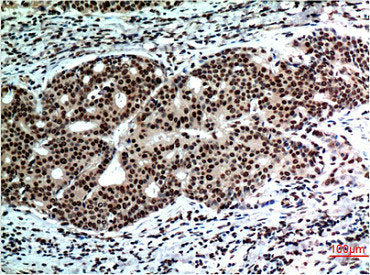 BECN1 Monoclonal Antibody