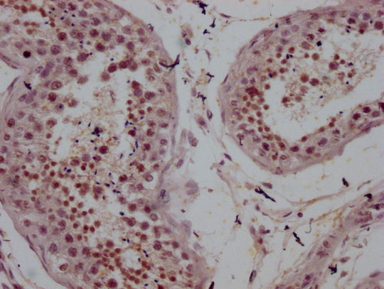AR Monoclonal Antibody