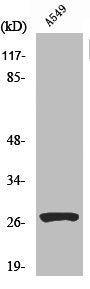 Cleaved-CTSD (L169) Antibody