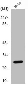 Cleaved-CTSL (T288) Antibody