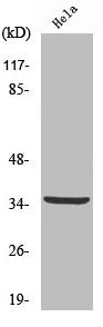 Cleaved-CTSV (L114) Antibody