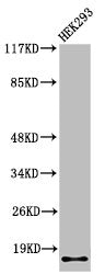 Cleaved-ITGA5 (E895) Antibody