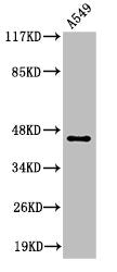 Cleaved-MASP1 (R448) Antibody