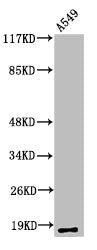 Cleaved-MMP1 (F100) Antibody