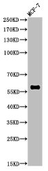 Mono-Methyl-RELA  (K314/K315) Antibody