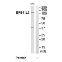 PPP2R5A Antibody