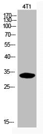 Acetyl-CDKN1C (K278) Antibody