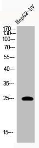 Acetyl-HMGB1 (K12) Antibody