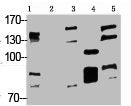 NR3C1 Antibody