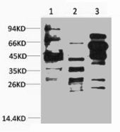 Acetyl Lysine Antibody