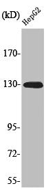 Phospho-EPHA2 (Y588) Antibody