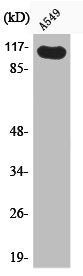Phospho-HGS (Y216) Antibody