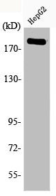 Phospho-IRS1 (S1101) Antibody