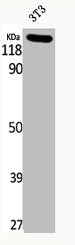 Phospho-JAK2 (Y1007) Antibody