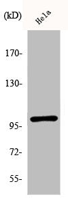 Phospho-NFKB1 (S893) Antibody
