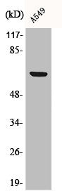 Phospho-RPS6KB1 (S447) Antibody