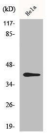 Phospho-CCR5 (S349) Antibody