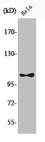 Phospho-EEF2K (S366) Antibody