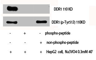 Phospho-DDR1 (Y513) Antibody