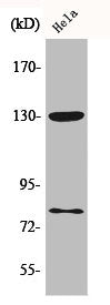 Phospho-ADD1/ADD2 (S726/713) Antibody
