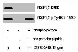 Phospho-PDGFRB (Y1021) Antibody