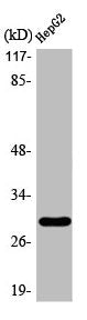 ACBD6 Antibody