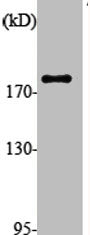 ALMS1 Antibody