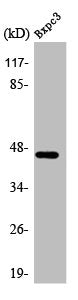 ADRB2 Antibody