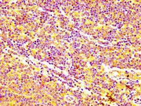 ABCC5 Antibody