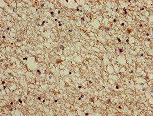 ABI2 Antibody