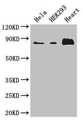 ABLIM1 Antibody