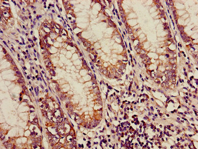 ACADM Antibody