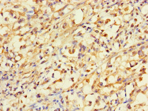 ACLY Antibody
