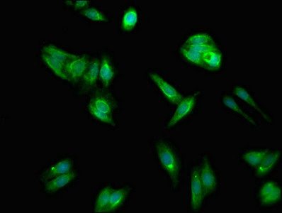 ACSL1 Antibody