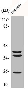 CTSB Antibody
