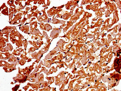 ADAMTS4 Antibody