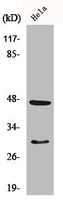CTSD Antibody