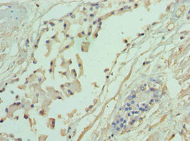 ADD1 Antibody