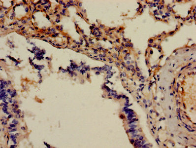 ADM Antibody