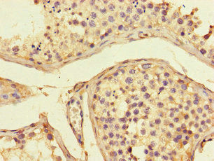 ADORA2A Antibody