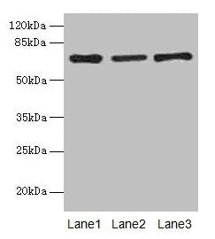 Afp Antibody