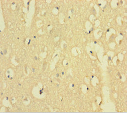 AFTPH Antibody