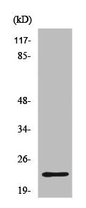 IGLL1/IGLC1/IGLC2/IGLC3/IGLC6/IGLC7 Antibody
